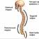 การนำเสนอในหัวข้อ scoliosis